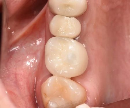 Healthy Smiles Dental - Las Vegas Dentist