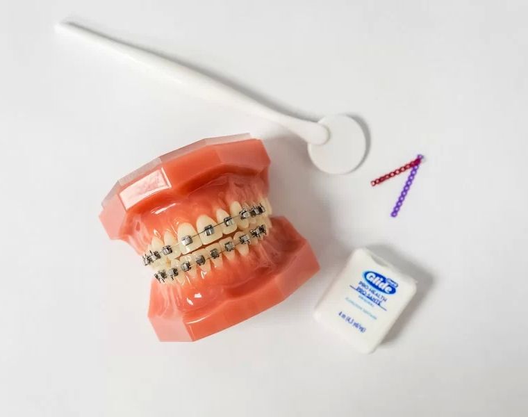 Braces R Us Orthodontics - Dr. Troy Williams