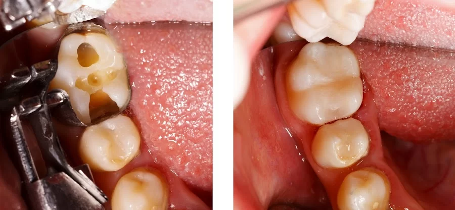 Okun Dentistry - Mesa 6