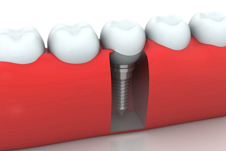 Okun Dentistry - Mesa 3