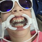MyOrthodontist Cary
