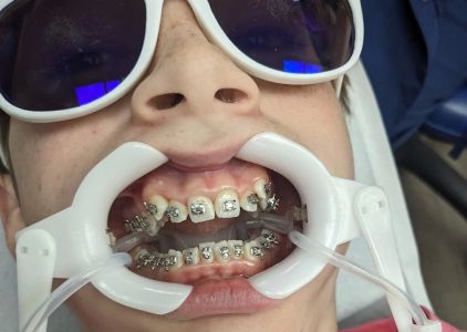 MyOrthodontist Cary