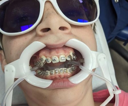 MyOrthodontist Cary