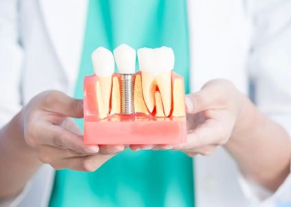 Charles Ashley Mann, DDS & Associates - Garner