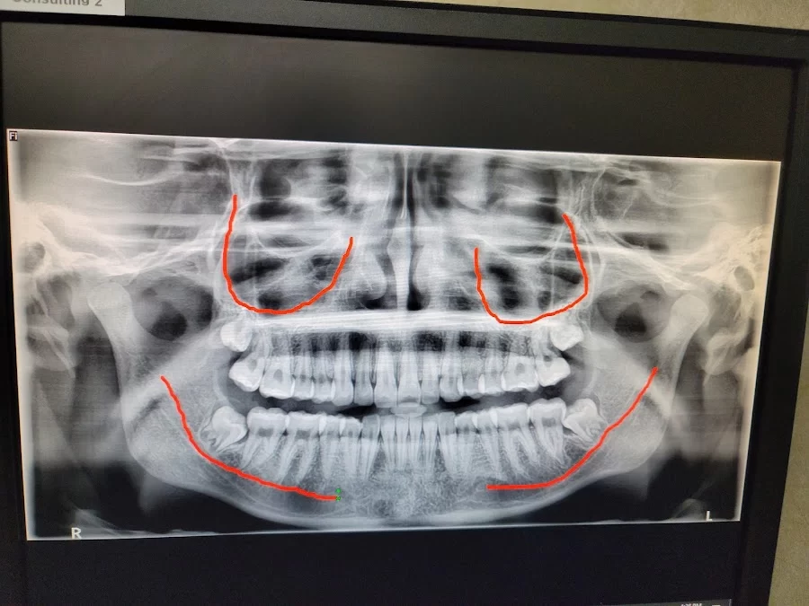 Fish and Sarhangian Oral and Maxillofacial Surgery 1