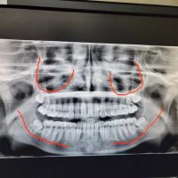 Fish and Sarhangian Oral and Maxillofacial Surgery ico