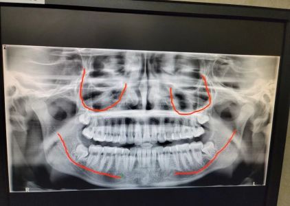 Fish and Sarhangian Oral and Maxillofacial Surgery