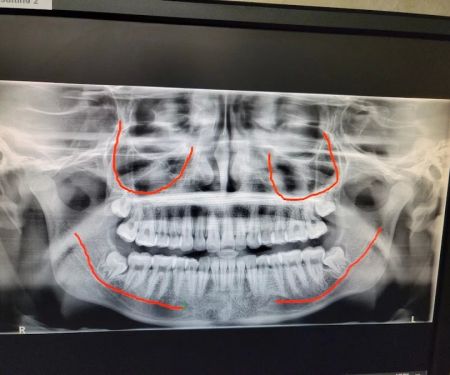 Fish and Sarhangian Oral and Maxillofacial Surgery