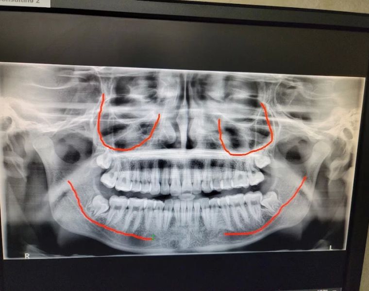 Fish and Sarhangian Oral and Maxillofacial Surgery