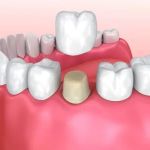 John A. Garza DDS, LVIF, FIAPA, BSC