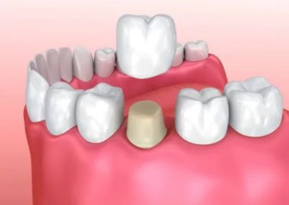John A. Garza DDS, LVIF, FIAPA, BSC