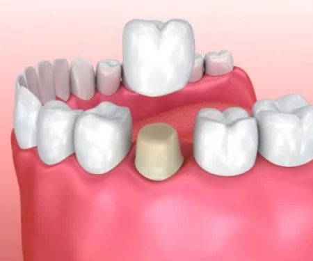 John A. Garza DDS, LVIF, FIAPA, BSC