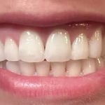 Kerr Endodontics