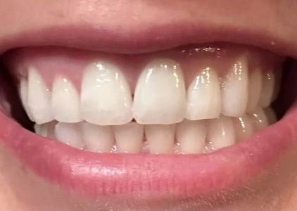 Kerr Endodontics