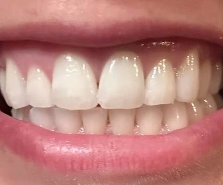 Kerr Endodontics