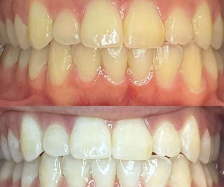 We Whiten