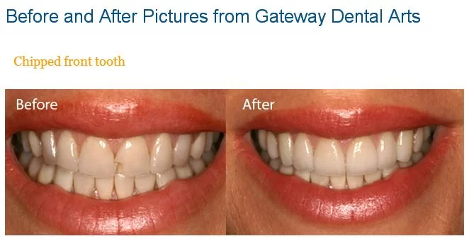 Gateway Dental Arts 2