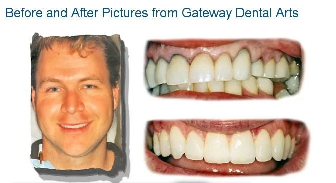 Gateway Dental Arts 6