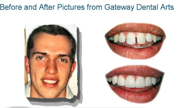 Gateway Dental Arts 5