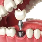 Holladay Hills Dental
