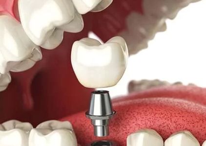 Holladay Hills Dental