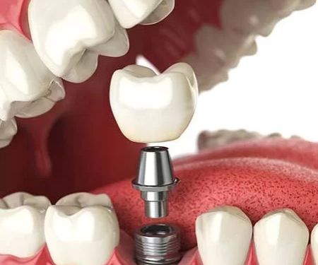 Holladay Hills Dental