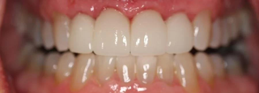 Timmons Cosmetic and Implant Dentistry 1