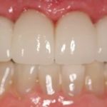 Timmons Cosmetic and Implant Dentistry