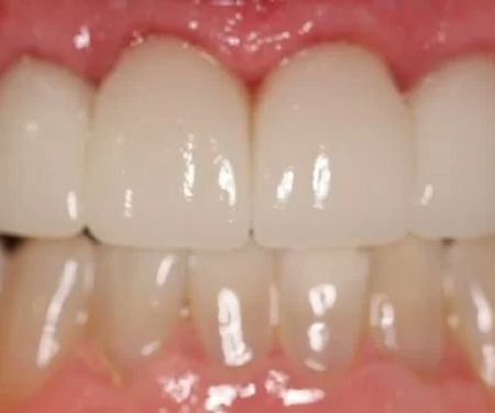 Timmons Cosmetic and Implant Dentistry