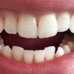 Somerset Dental Professionals LLC