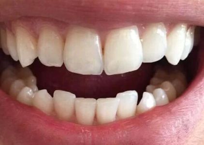 Somerset Dental Professionals LLC