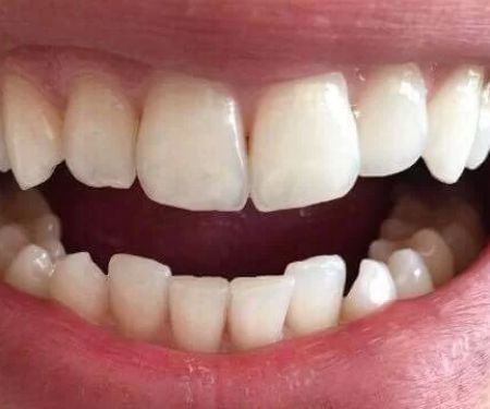 Somerset Dental Professionals LLC