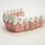 Auburndale Dental Newton