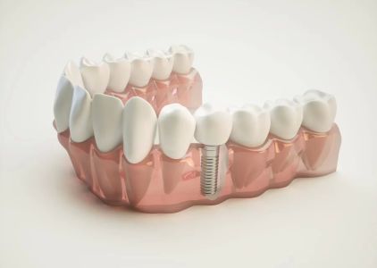 Auburndale Dental Newton