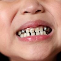 Smile Center ico