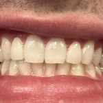 Willowview Dental Care