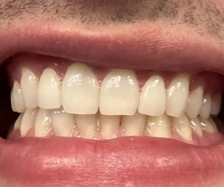 Willowview Dental Care