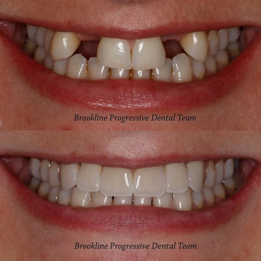 Brookline Progressive Dental Team 7