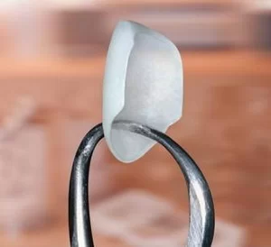 DR RAJDEEP S RANDHAWA, B.D.S, D.D.S LASER, BIOMIMETIC, COSMETIC DENTISTRY 1