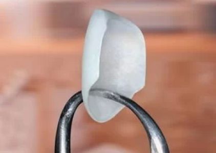 DR RAJDEEP S RANDHAWA, B.D.S, D.D.S LASER, BIOMIMETIC, COSMETIC DENTISTRY
