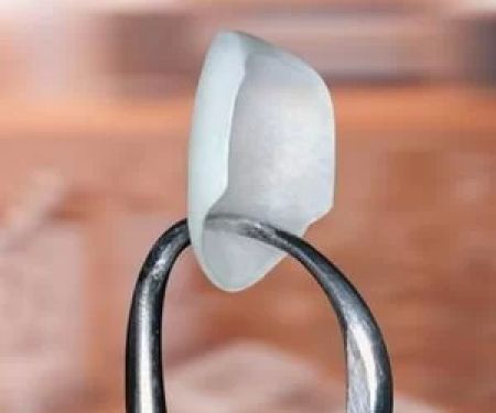 DR RAJDEEP S RANDHAWA, B.D.S, D.D.S LASER, BIOMIMETIC, COSMETIC DENTISTRY