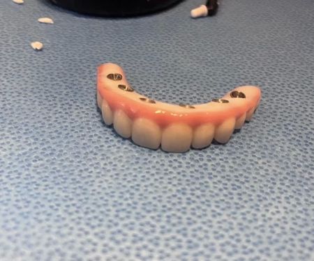 Affordable Dentures & Implants