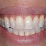 Kenneth Hovden DDS