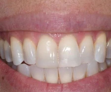 Kenneth Hovden DDS
