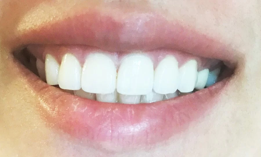 Hollywood Smile Dental 3