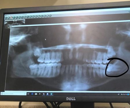 Clevemorse Family Dentistry