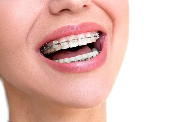 All Family Dental Care 1