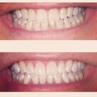Caring Tooth Dental Clinic Northridge ico