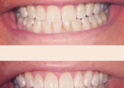 Caring Tooth Dental Clinic Northridge