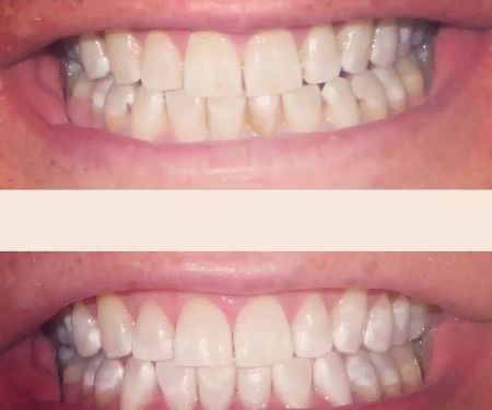 Caring Tooth Dental Clinic Northridge